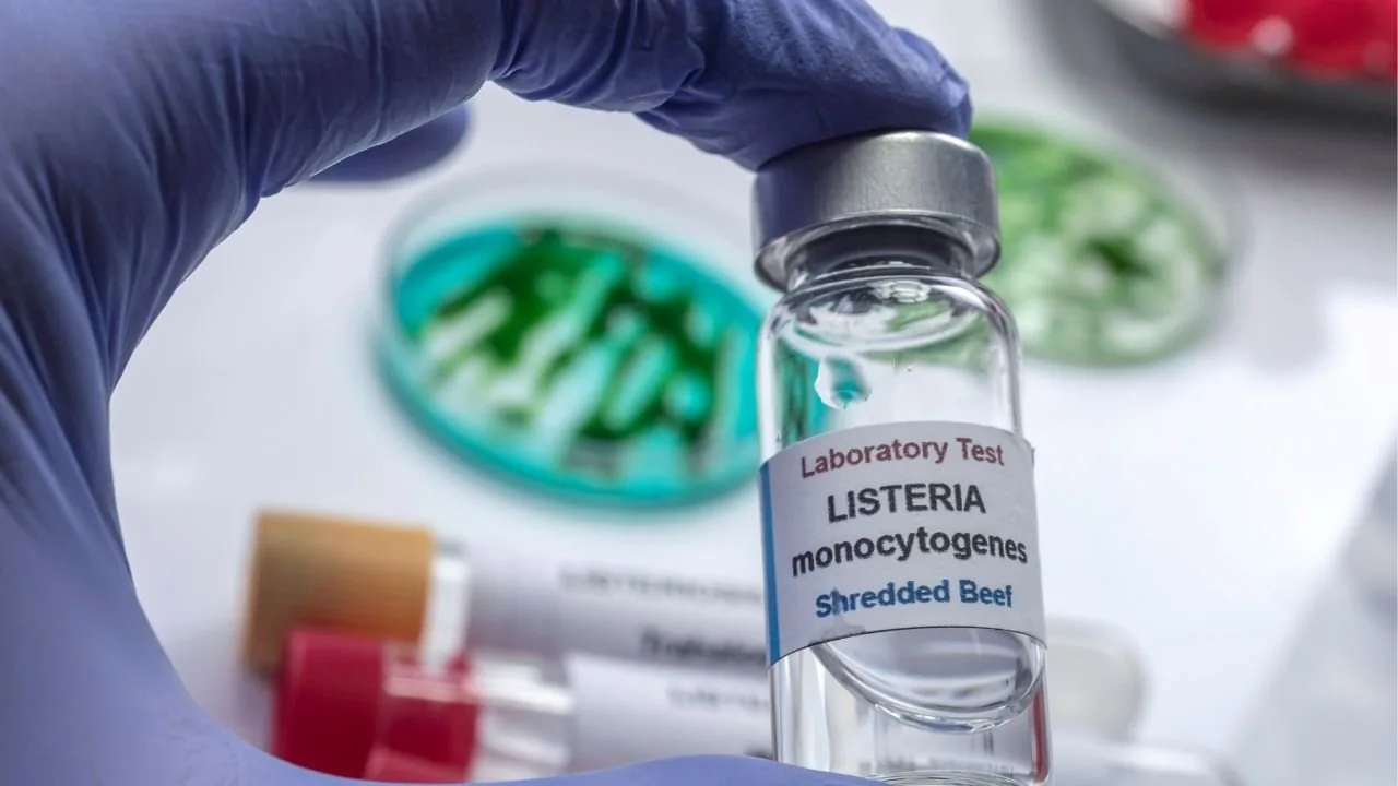 Listeria Bakterisi Gıda Güvenliğinde Kritik Tehdit: Belirtiler ve Korunma Rehberi