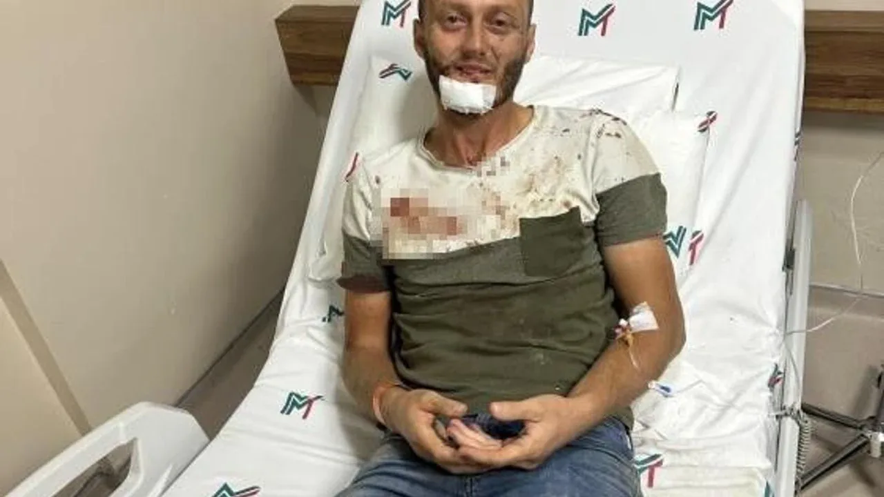 Antalya Serik’te gürültü tartışması sopalı kavgaya döndü: 5 kişi gözaltında