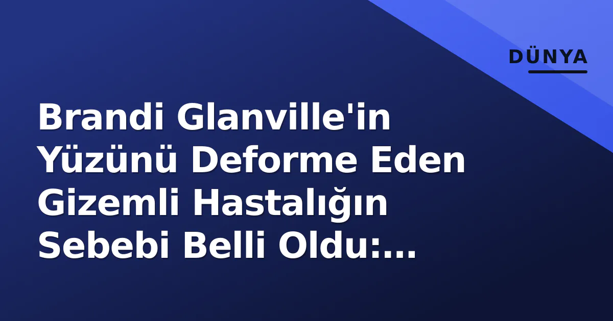 Brandi Glanville’in Yüzünü Deforme Eden Gizemli Hastalığın Sebebi Belli Oldu: Parazit ve İmplant İlişkisi Ortaya Çıktı